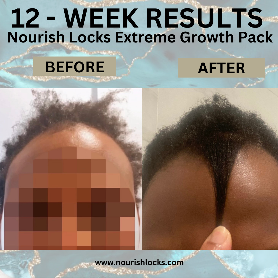 EXTREME GROWTH PACK