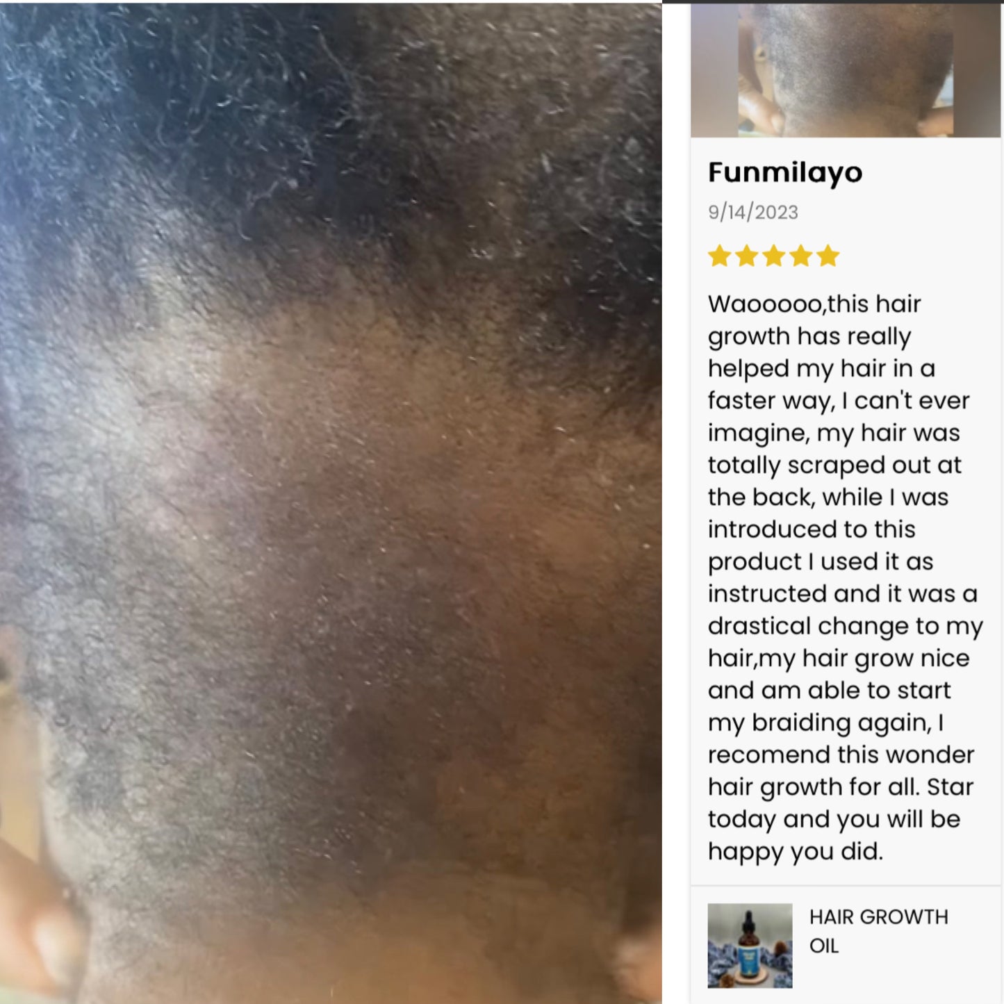 HAIR GROWTH OIL