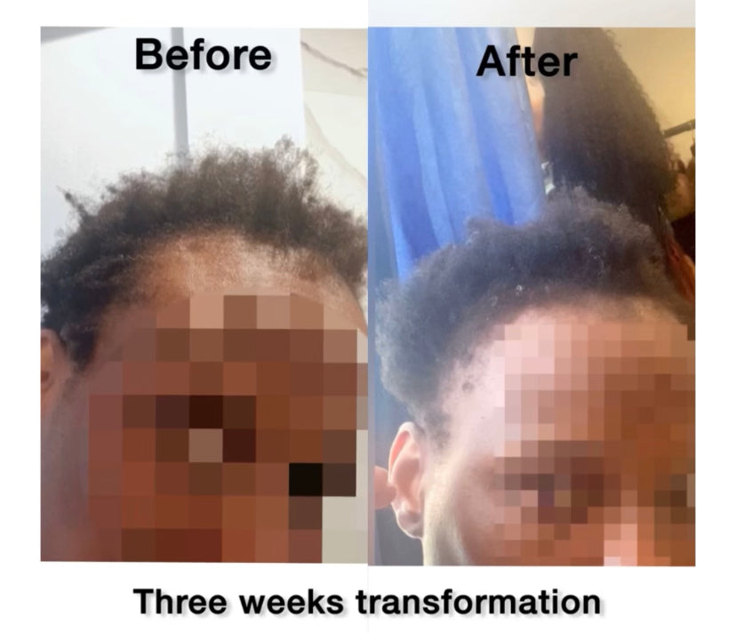Hair Growth Oil - 2 Bottles